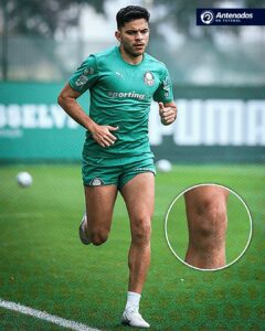 Bruno Rodrigues está de volta após duas cirurgias graves no joelho.

O atacante …