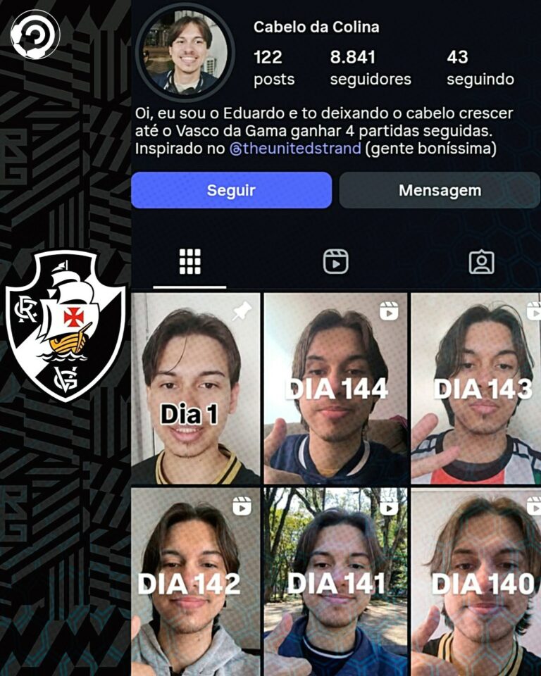 Eduardo, vascaíno, prometeu deixar o cabelo crescer até o time vencer 4 partidas…