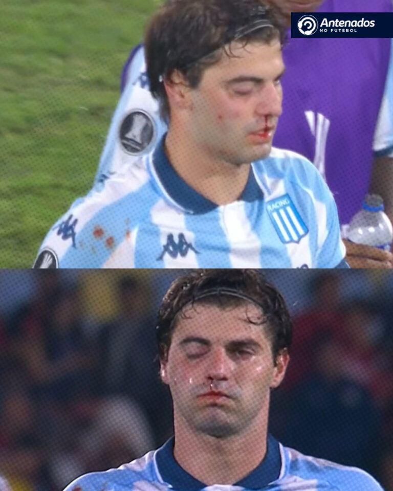 ISSO É LIBERTADORES DA AMÉRICA! Sosa, do Racing, ficou bastante machucado após …